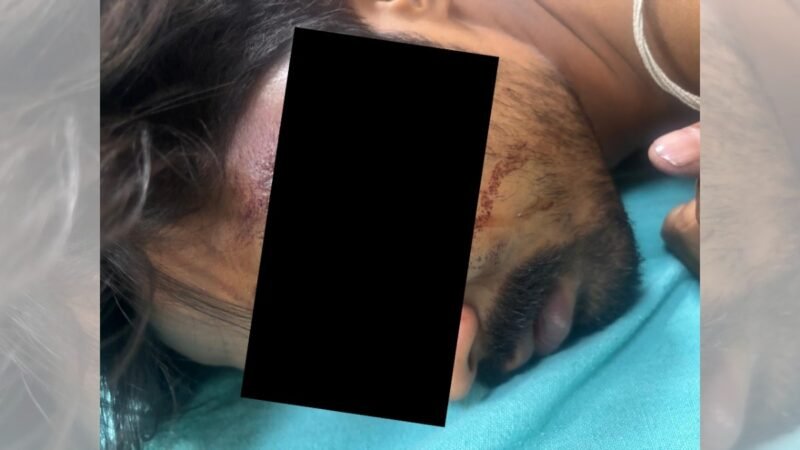 Gurugram society residents attack lift operator who rescued them, he loses an eye