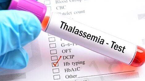 What happens if both parents carry the thalassemia gene? Doctors explain the risks