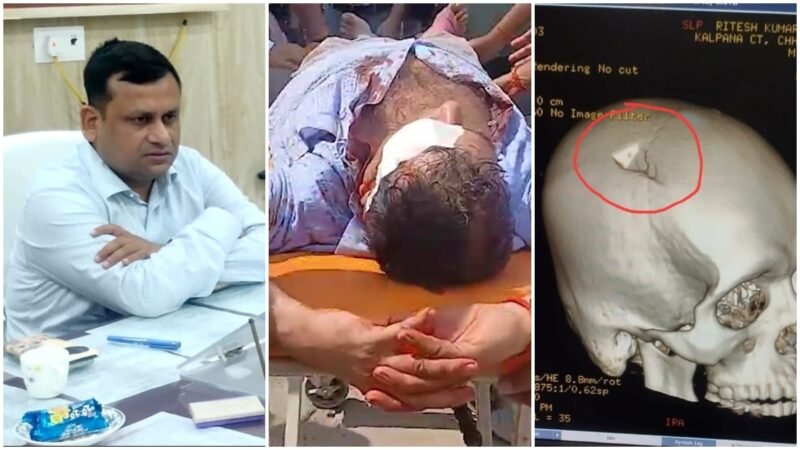 Video: Bihar officer hit by iron weight during NEET protest, suffers skull fracture