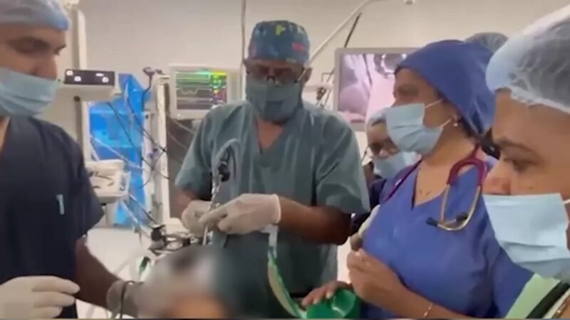 Ahmedabad doctors remove betel nut, water chestnut stuck in windpipes of two children